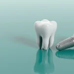 Dental Implants Covered by Medical Insurance